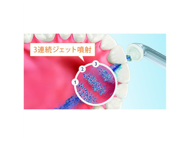 フィリップス、歯間の歯垢除去率99.9％「ソニッケアー エアーフロス