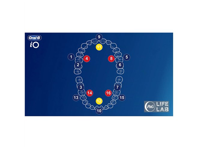 ブラウン、ブラシ1本1本を振動させて歯垢を除去する「オーラルB iO」2