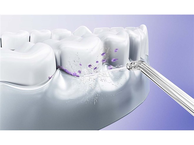 I-ne、超微細な泡を採用した口腔洗浄器「ウルトラファインバブル