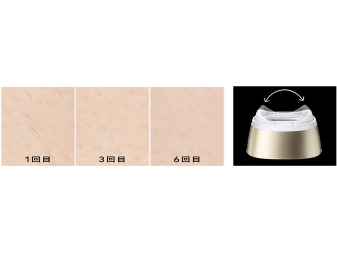 ブラウン、可動式ヘッドで関節に密着する光美容器「シルクエキスパート