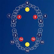 �I�[����B iO8 �z���C�g �A���o�X�^�[