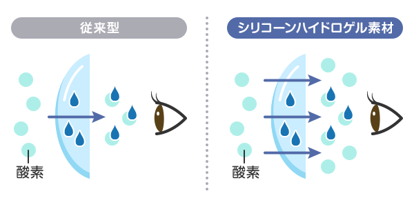 �V���R�[���n�C�h���Q���Ə]���f�ނ̔�r�C���X�g