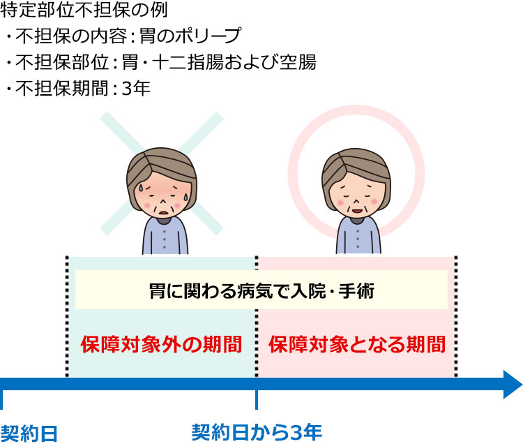 特定部位不担保の例
の図