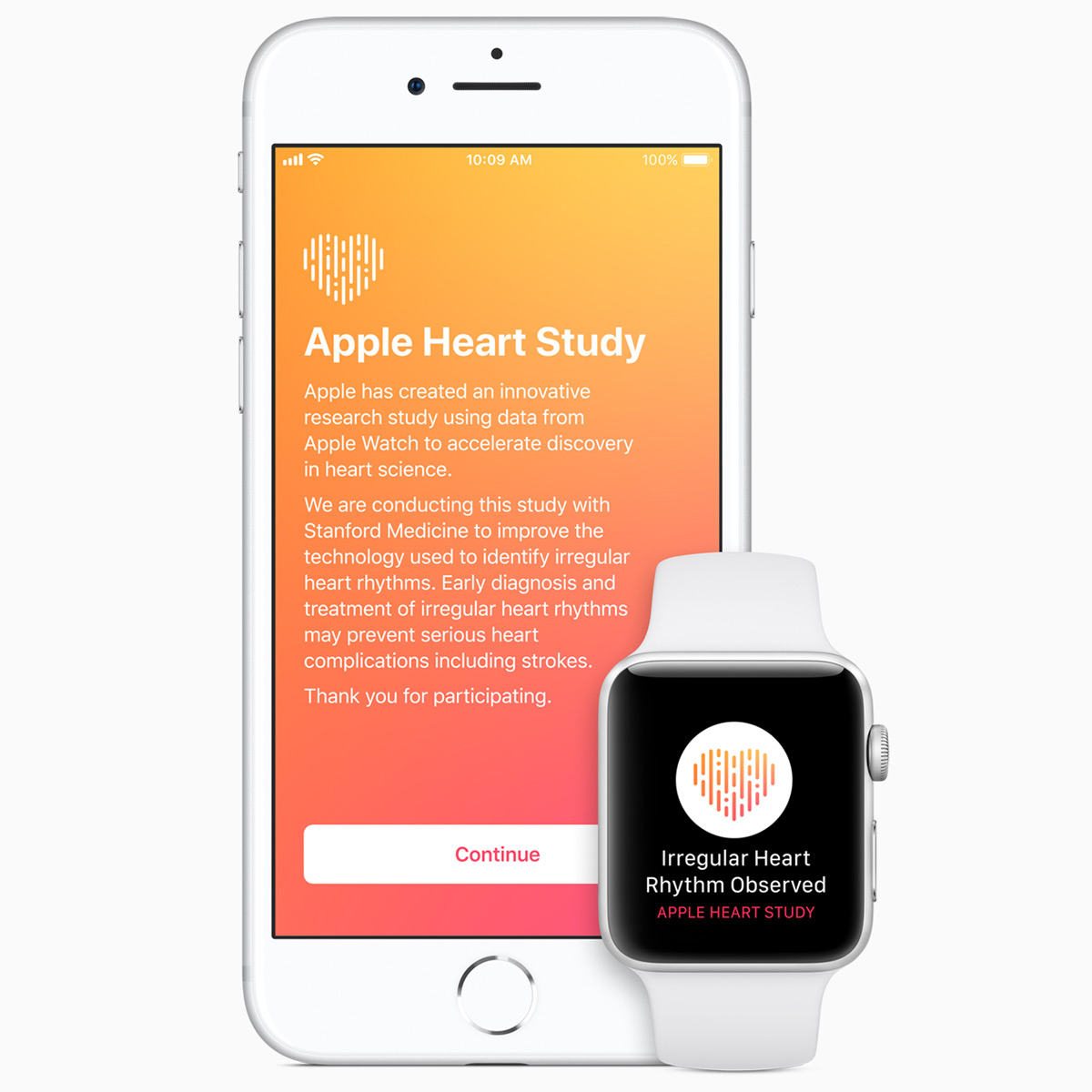 uApple WatchvŐS[ד͂ǂꂭ炢mɌmł̂H [U[Lp炩