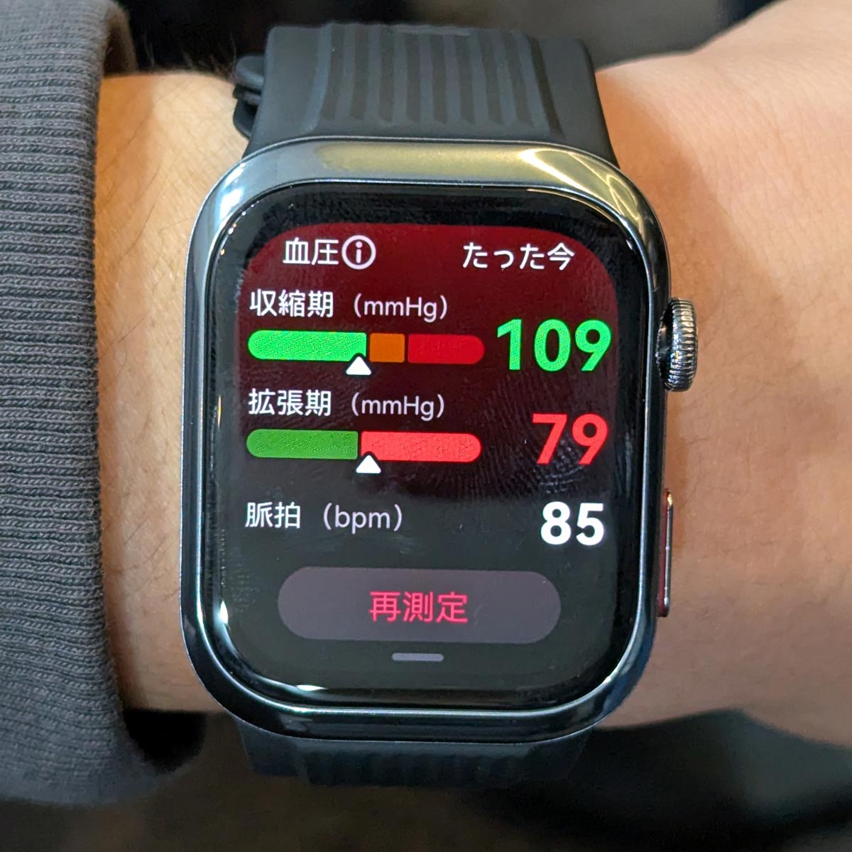 血圧が測れるスマートウォッチ登場! そのうえ心電図までチェックできるなんて