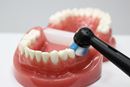 高い歯垢除去力を誇る電動歯ブラシ「オーラルB iO」シリーズに価格を抑えた新モデル登場