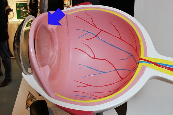 NƂƊ̃Y̖ʂ̂AXɓ物FɕωĂ܂