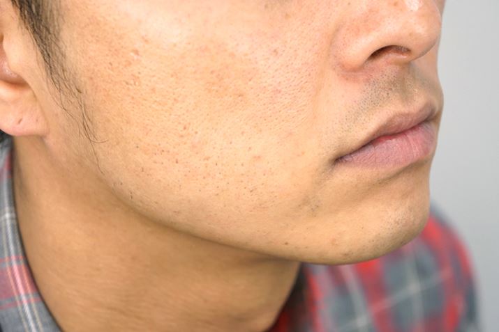 ̒[ɒcmFł邪Aڗقǂ̂̂łȂ