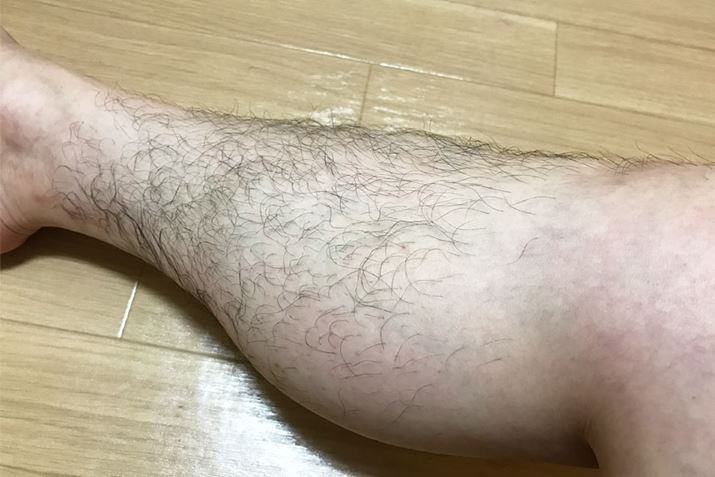 �W���I�Ȓj���̃��_�т��Ǝv���܂�