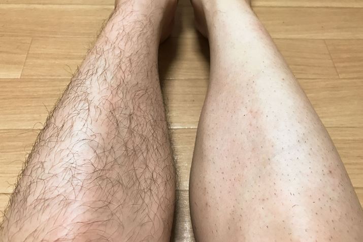 �������r