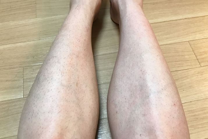 �����J�~�\���ŉE�����уN���[���ł�