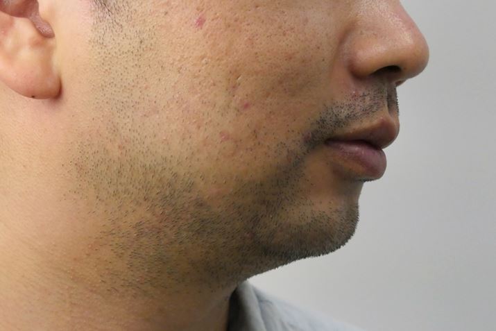 A݂炠AɂĎŐ̂悤ɐĂ闝zIȔZqQ