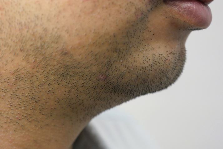 ZĂA񌳂̃qQ͐QĐĂ̂킩