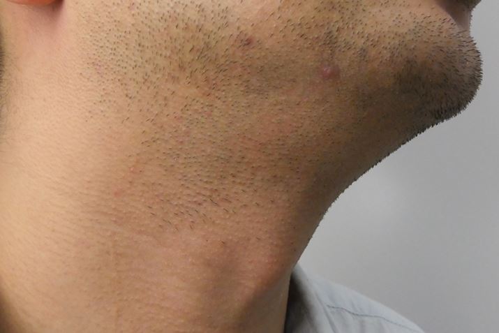 Xg[Nł̒オI p҂́uƒĂ̂ɑSRɂȂIvƋBȂ