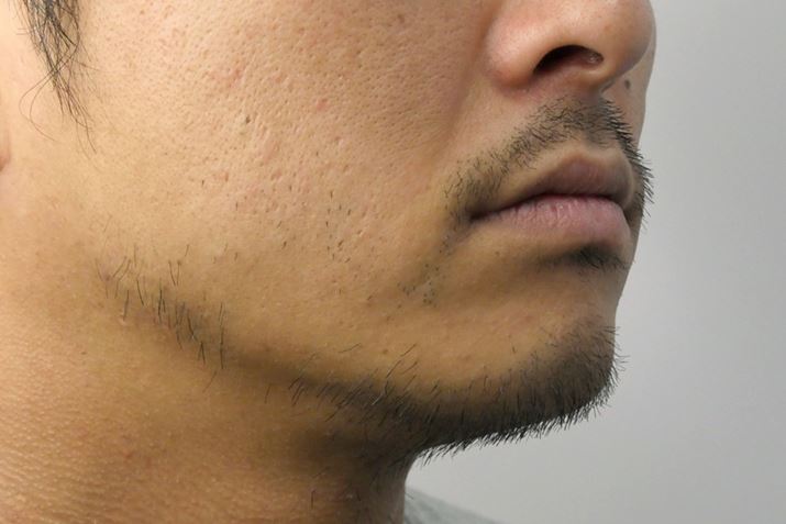 1TԐL΂qQBƂɒтW܂ĂBȊÓA܂ɒтĂ