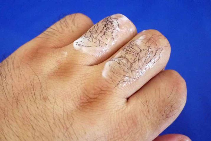 10o߁Bꂩ珜эƂɓ܂