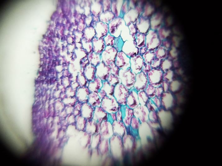 V_̍s̍זE܂łĂAiڂĂ̂̓X}[gtHŎBe߁j