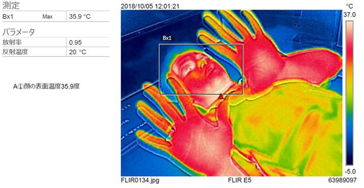 ̕\ʍōx́A35.9܂ŏ㏸BĂ̂Ђ̉x炢