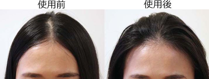 ς蕪ڂtĂ؂ƂĂɁARȃ{[o܂