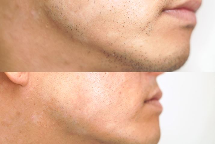 uuE V[Y9vɂVF[rOOƃVF[rO