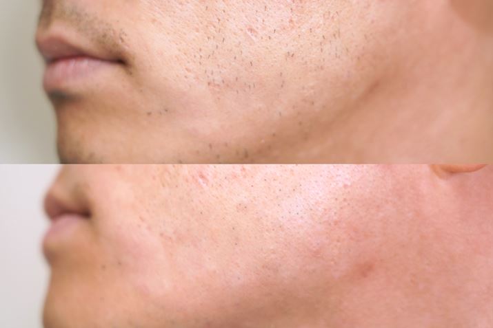 uWbg XLK[hvɂVF[rOOƃVF[rO