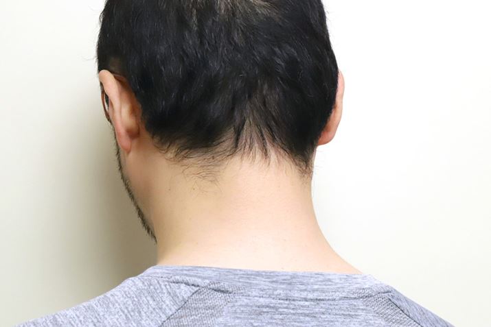 ̓nQ܂߂3mmɑĂ̂ŁA܂ŐLт̂̓w^10NԂ肮炢cc