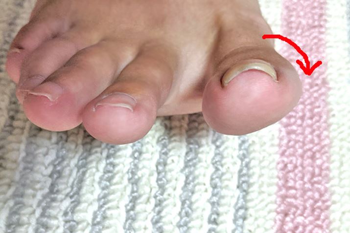 Ȃʐ^ŋkłAeẘO̒܂ƘpȂĂ̂킩܂ł傤iŎ̑B̂ēłˁj