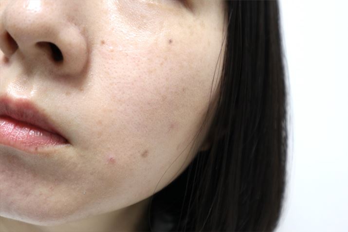 hɂȂ肷AKxȃcRɎdオ܂IJo[͂܂