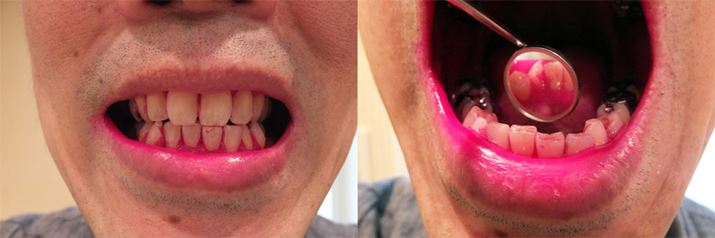 CF܂Ȗ_ŎɓhzƁA䂷Ɩc镔Ԃc܂B̗́Aɔd̕قƂǖĂ炸AVbN󂯂܂