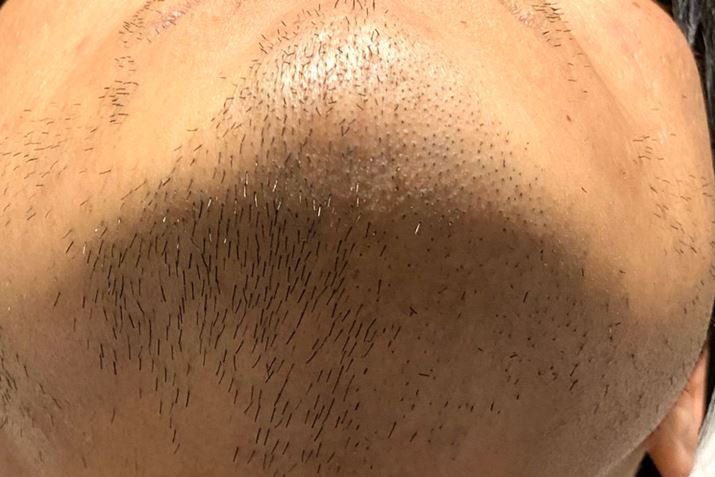 ʐ^̉EXg[NĂ݂BꂾŁAqQ܂Œ