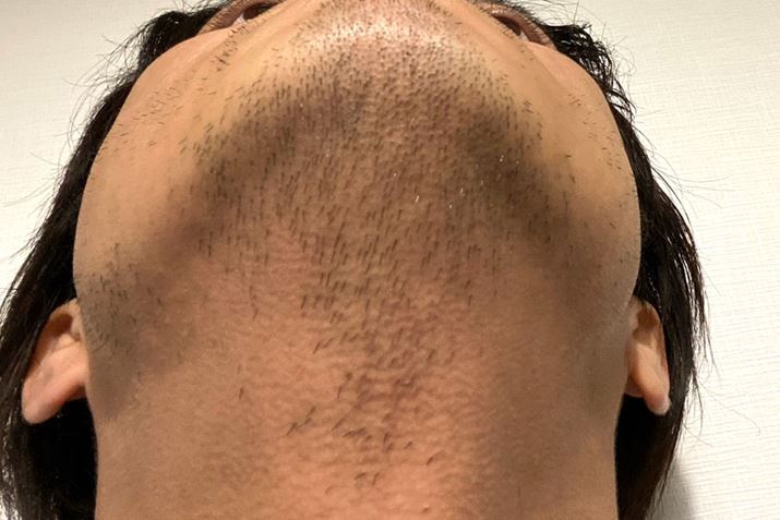 qQASqQ͂ƁAj₠̃qQ܂΂ɐĂ