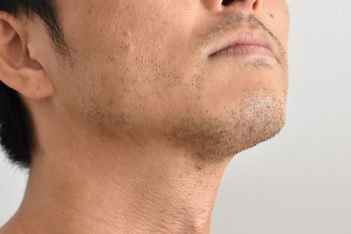 M҂3ԐL΂qQBmɕ@AS̉́AOɃVF[rOȂƁAcoĂ܂