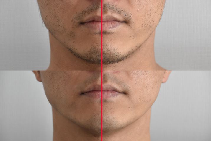 オOŁAB̃uEŏʃfƌׂAuuEV[Y9Proviʐ^juuEV[Y9viʐ^EjAꂼ1`2قǂłꂢɒグꂽ