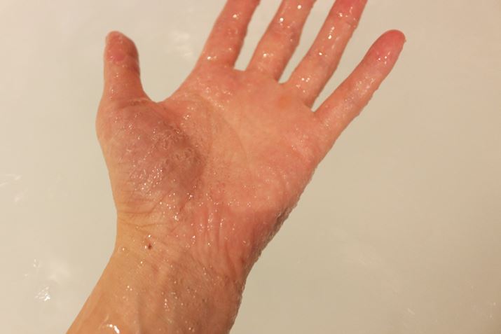 DoĂ݂ƁA̕ɑʂ̖ABu][gouvقǂ̖A̎h͊܂񂪁ADAŖAĝAŕ܂悤ȏԂɂȂĂ悤łBAȂ񂾂炩Ȃ悤ȋCcc