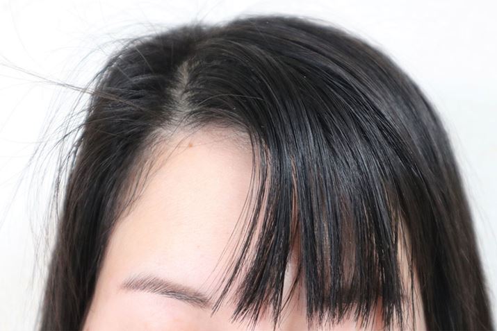 ȏkы኱ꂩĂĂA{̃NZCɂȂĂ܂BNZтTTɂȂ邱ƂŉPȂȁccȒW҂𐅃g[ggɈCɔw킹Ă݂悤Ƃ܂B