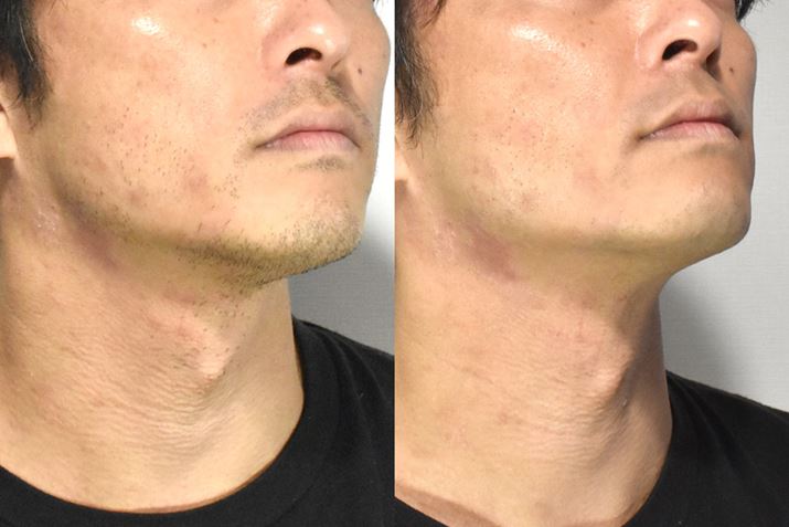 L΂qQij3ԂقǃVF[rOrtHA^At^[BƐ[łĂ邱Ƃ킩BȂAʐ^̔̐Ԃ݂́AAgs[畆ɂ̂ŁA킩Â炭ċkAVF[rOɂAqqAcbpAԂ݂͂Ȃ