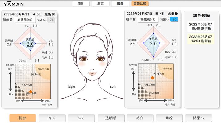 j̉ӂɑu𓖂ĂđBM҂̎N40΂BgpO̔N46΂ƂUXȌʂ̂ɑ΂Agp͉39΂Ɓ|7ΎԂI