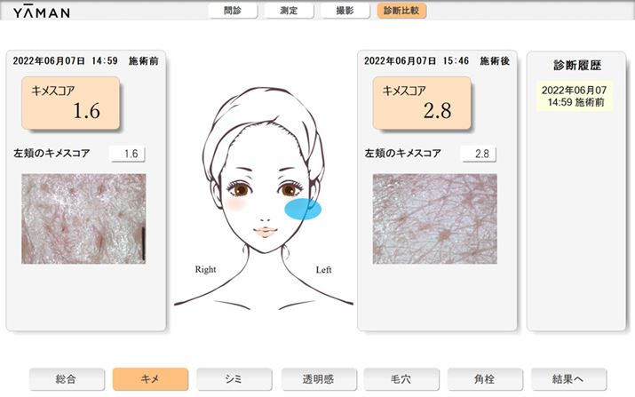 ̃rtHA/At^[̎ʐ^B炩ɔ܂Alq