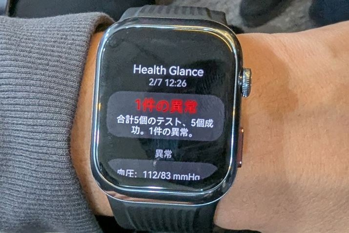 u^bvwXPA`FbNv̌ʁA܂ُ̈킪oBʎł́Aa@֎f邫ɂȂ邾낤