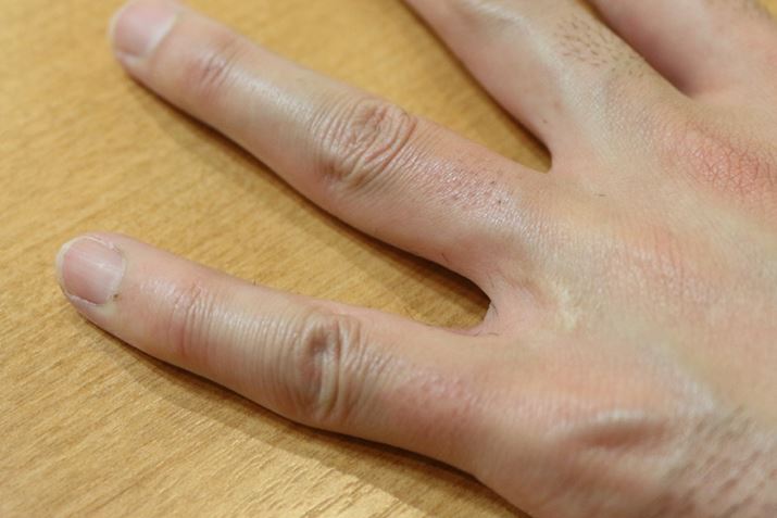 ꂩɑ΂ĒEуwbh5قǂƁAvȏɂꂢɂȂ܂