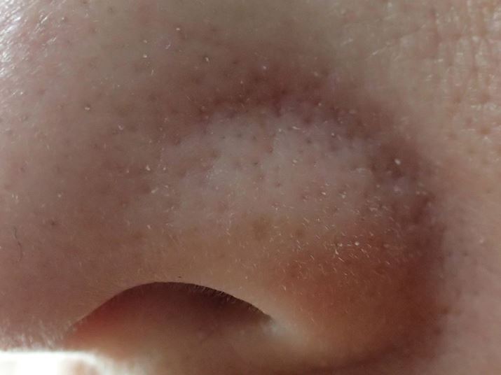 ь̉ňԋCɂȂ̂́A@BpA|c|cƖڗ炵