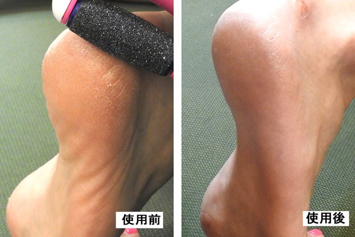 ЂъĂƂ̃KTKT͊Tˎ܂