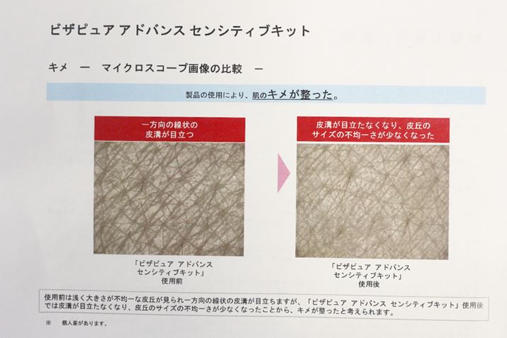 uZVeBuLbgv́uvu^bsOvuڌPAvɂÃLƂʂ