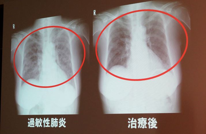 Jr̉ߕqx̃gQʐ^BxɔeoĂ܂Bꂵcc