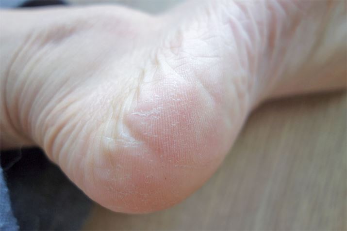 4ځBS̓IɃJTJTĂ܂ˁcH