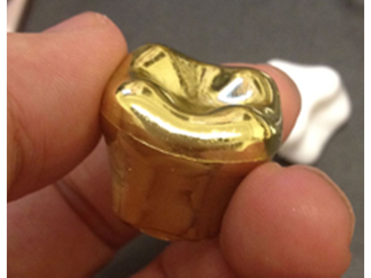 金歯もあるよ！ “歯”そっくりのマグネットの発想がすごい！ - 価格.com