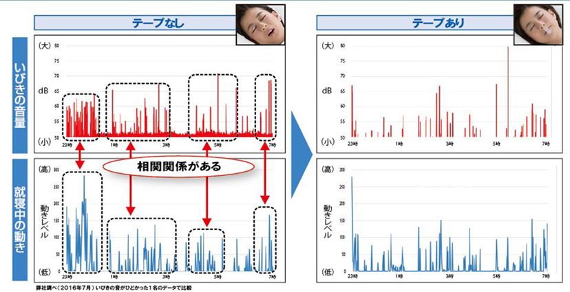たわし枕”に“口封じテープ”!? 人気の眠活グッズ実力診断