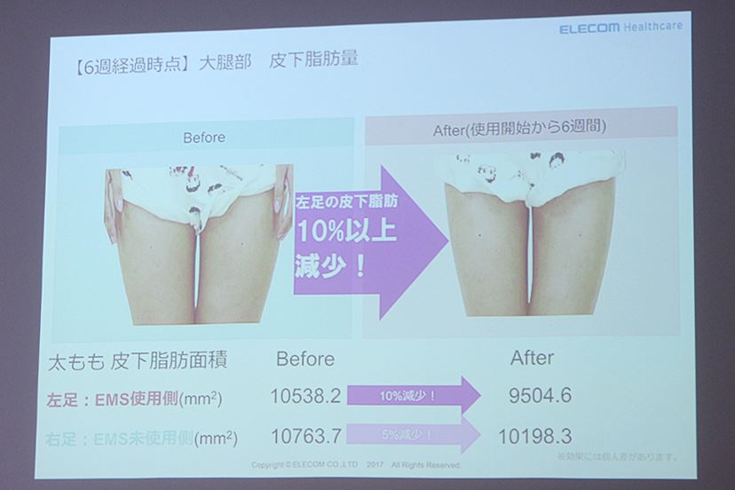 エクリア リーン 目指せ「#腹筋女子」！ エレコムのEMS機器「エクリア リーン」で