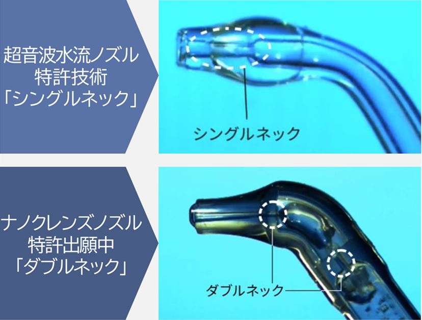 歯茎にやさしい口腔洗浄器！ 「ジェットウォッシャー」は“気泡