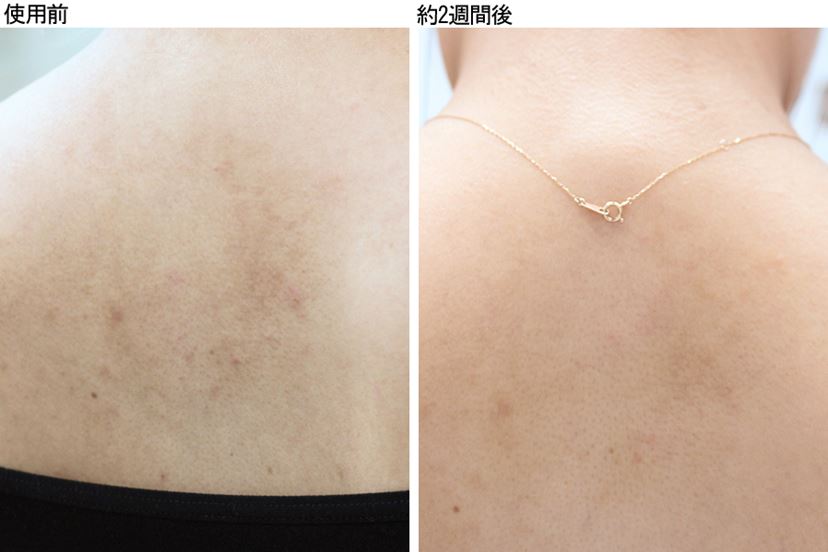 高濃度水素風呂「グリーニングスパ」で“浸かるだけ美容”を始めよう